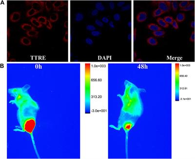 NIR Photosensitizer for Two-Photon Fluorescent Imaging and Photodynamic Therapy of Tumor